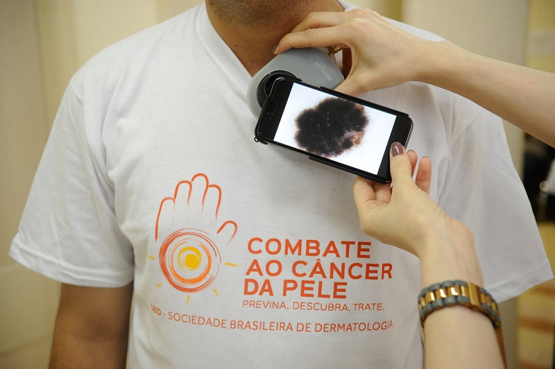 #DezembroLaranja: mutirão faz exames preventivos gratuitos de câncer de pele