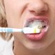 Atitude simples: cuidado ao escovar os dentes previne diversas doenças, afirma especialista