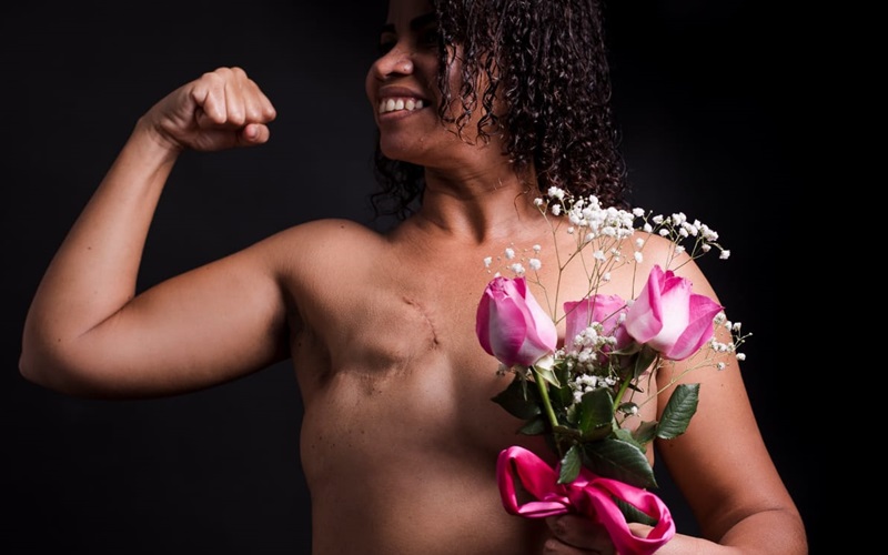 Exposição fotográfica pretende aumentar autoestima de mulheres com câncer de mama