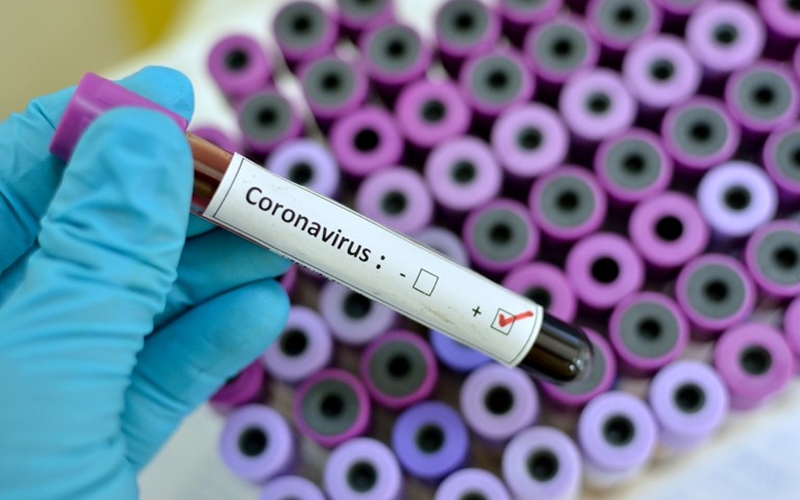 Coronavírus: 30% dos óbitos na Bahia foram pessoas com menos de 60 anos e sem doenças crônicas
