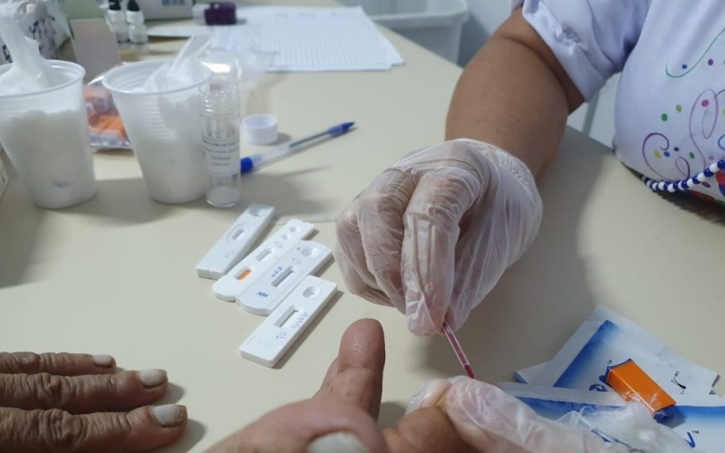 Coronavírus: Sesab estabelece critérios para utilização de testes rápidos por prefeituras