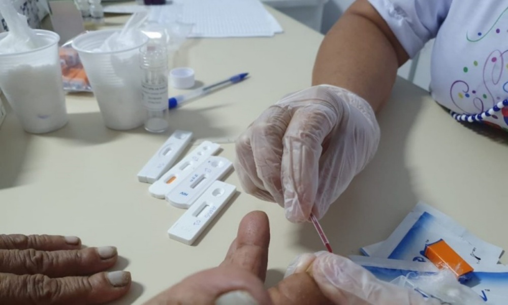 Brasil ultrapassa 7,2 milhões de casos de coronavírus