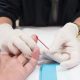 Autoteste de HIV já está disponível em Camaçari; saiba como fazer