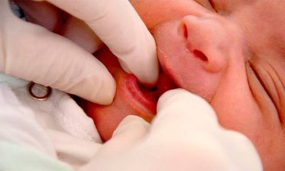 Faculdade oferece teste da linguinha gratuito em bebês de até seis meses
