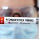 Bahia acumula 30 casos confirmados de Monkeypox