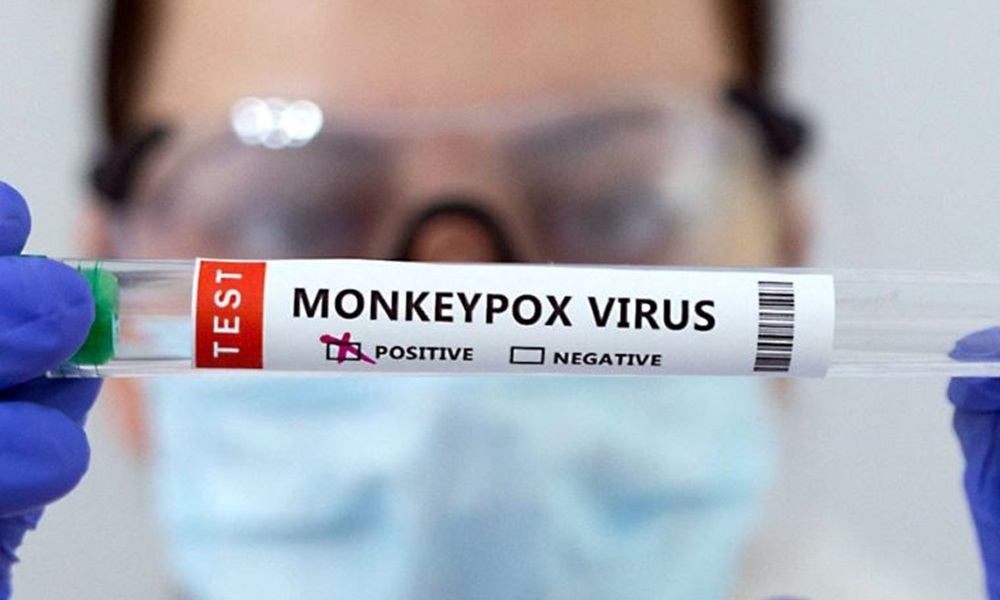 Salvador confirma terceiro caso de varíola dos macacos