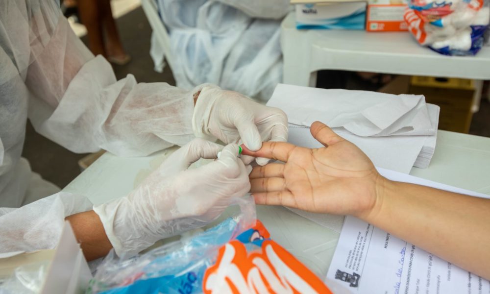 Julho Amarelo: Sesau promove semana de ações de combate às hepatites virais em Camaçari