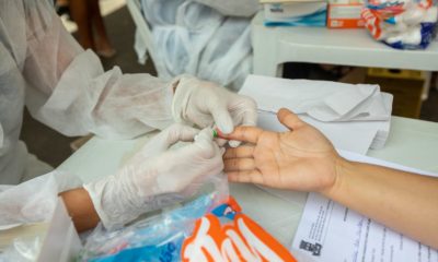 Camaçari registra 140 novos casos de HIV em 2022