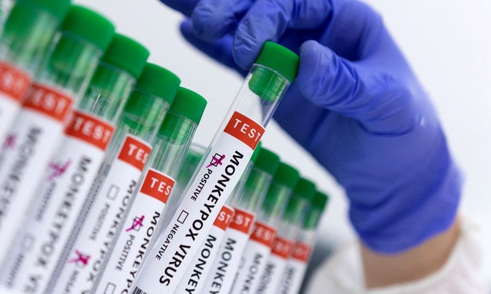 Bahia registra mais três casos de Monkeypox e totaliza 60 infectados