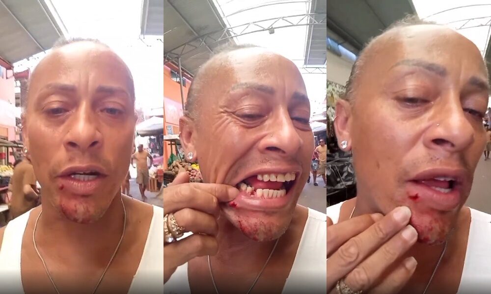 Ator de ‘Ó Paí, Ó’ é agredido por segurança na Feira de São Joaquim e perde dentes