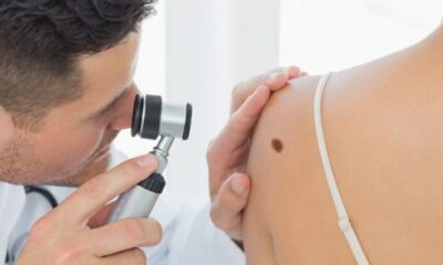 Câncer de pele: mais de 10 mil baianos devem ter diagnóstico da doença em 2023