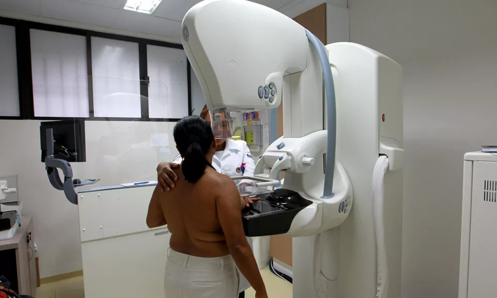 No Mês da Mulher, CAM oferece 300 mamografias gratuitas para pacientes de 40 a 70 anos
