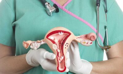 Câncer de colo de útero vai atingir mais de 17 mil mulheres por ano no Brasil