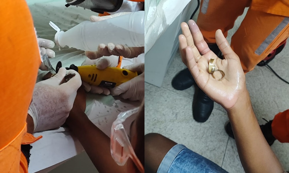 Bombeiros do 10° GBM retiram anel preso no dedo de adolescente em Dias d'Ávila; veja vídeo