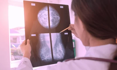 Outubro Rosa: clínica disponibiliza 100 mamografias gratuitas em Salvador